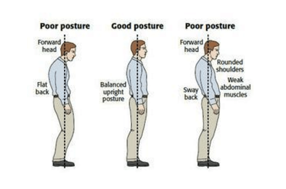 Źródło obrazu: http://www.thephysiocompany.com/blog/stop-slouching-postural-dysfunction-symptoms-causes-and-treatment-of-bad-posture