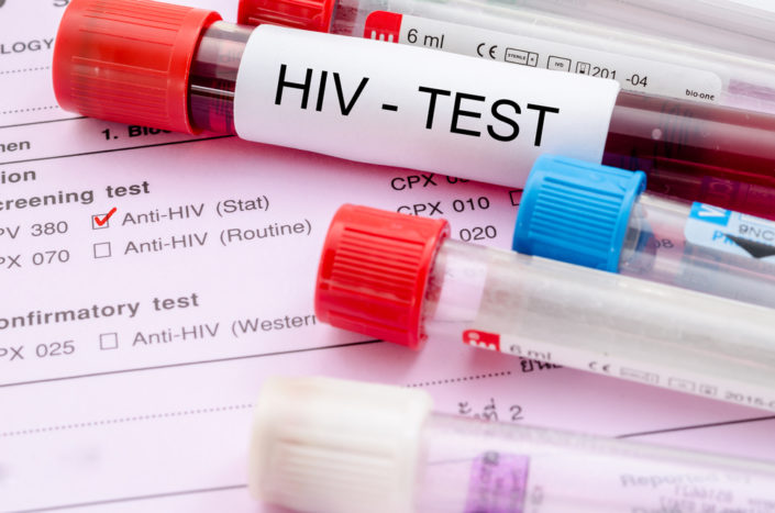 Test na HIV