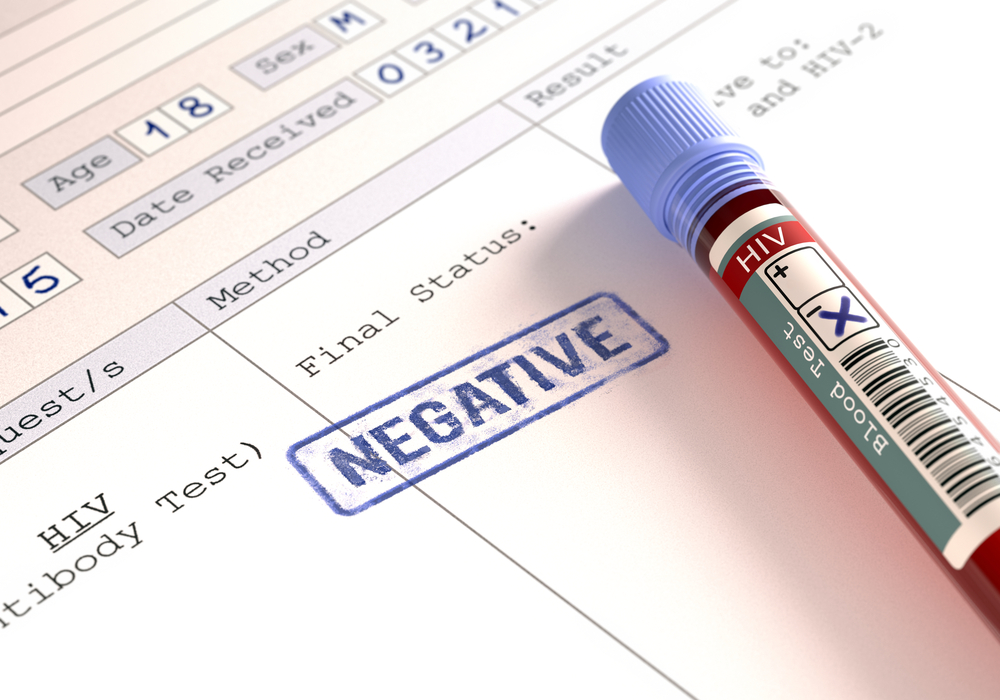 znaczenie wyników negatywnego testu na HIV