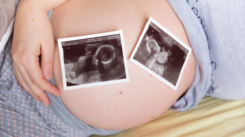 ryzyko zajścia w ciążę z bliźniętami znika