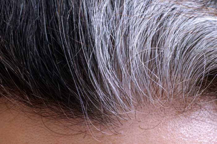 przyczyny siwienia włosów łonowych